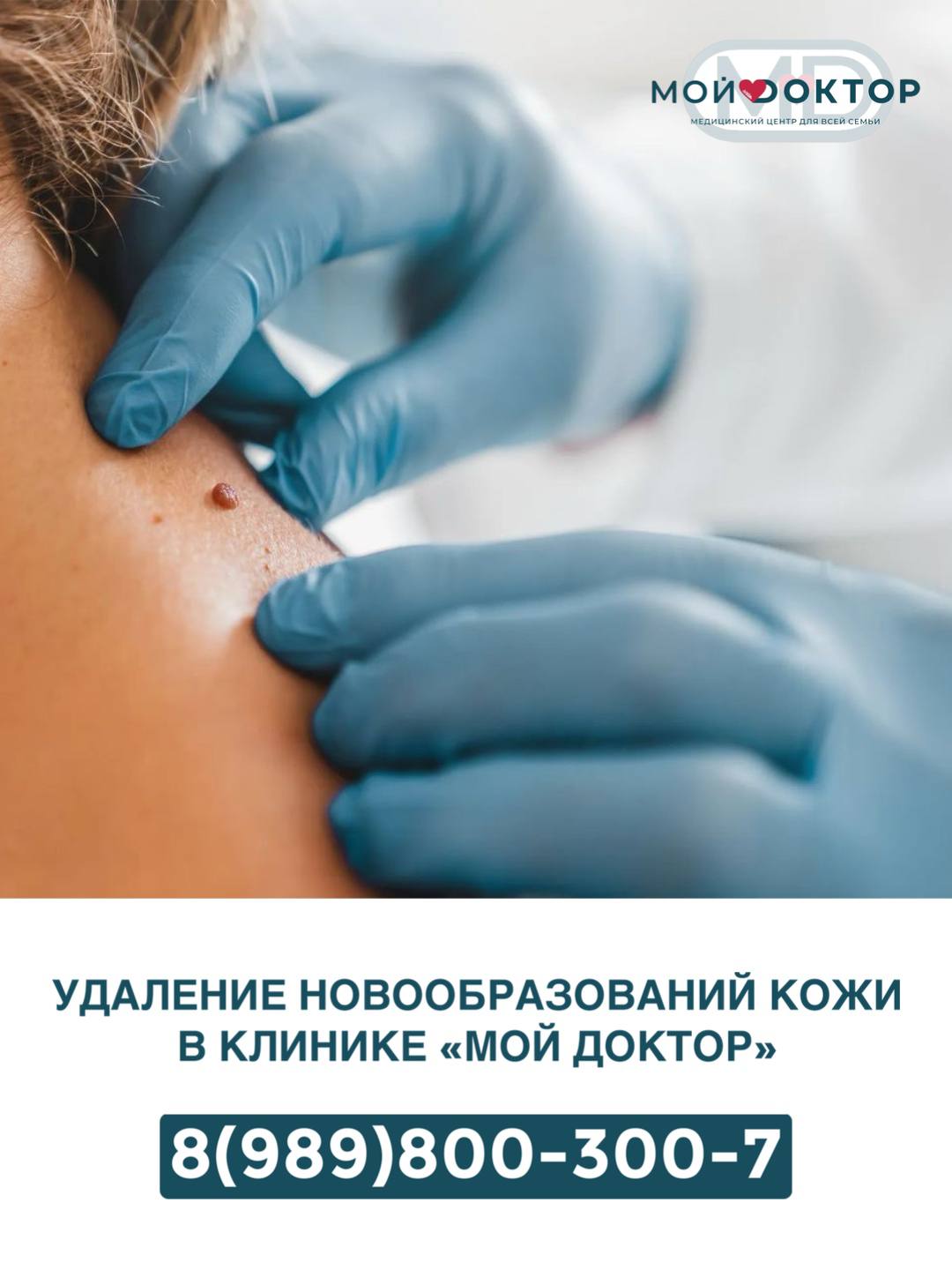 УДАЛЕНИЕ НОВООБРАЗОВАНИЙ КОЖИ В ЦЕНТРЕ АМБУЛАТОРНОЙ ХИРУРГИИ В АРМАВИРЕ