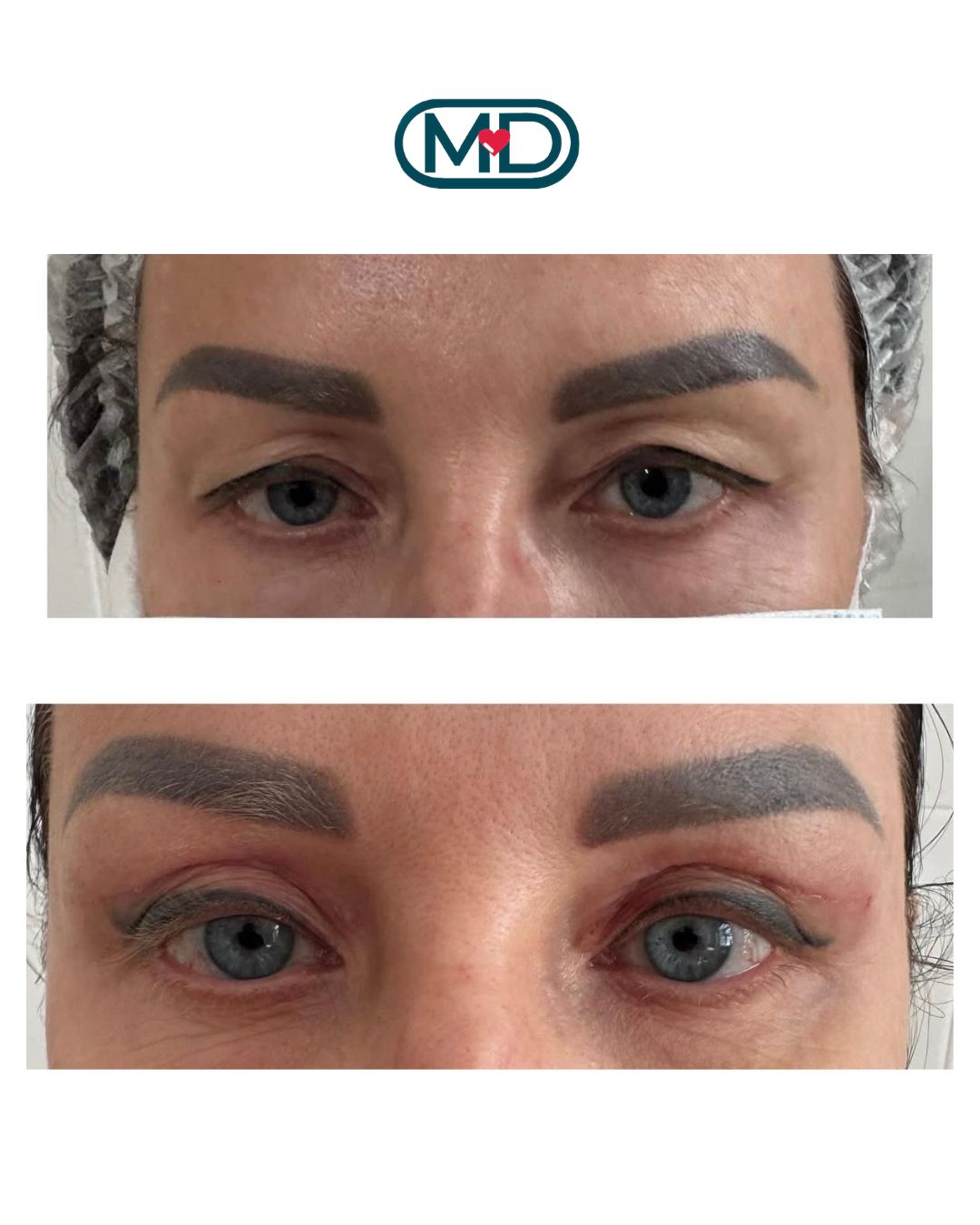 ПЛАСТИКА ВЕК В АРМАВИРЕ