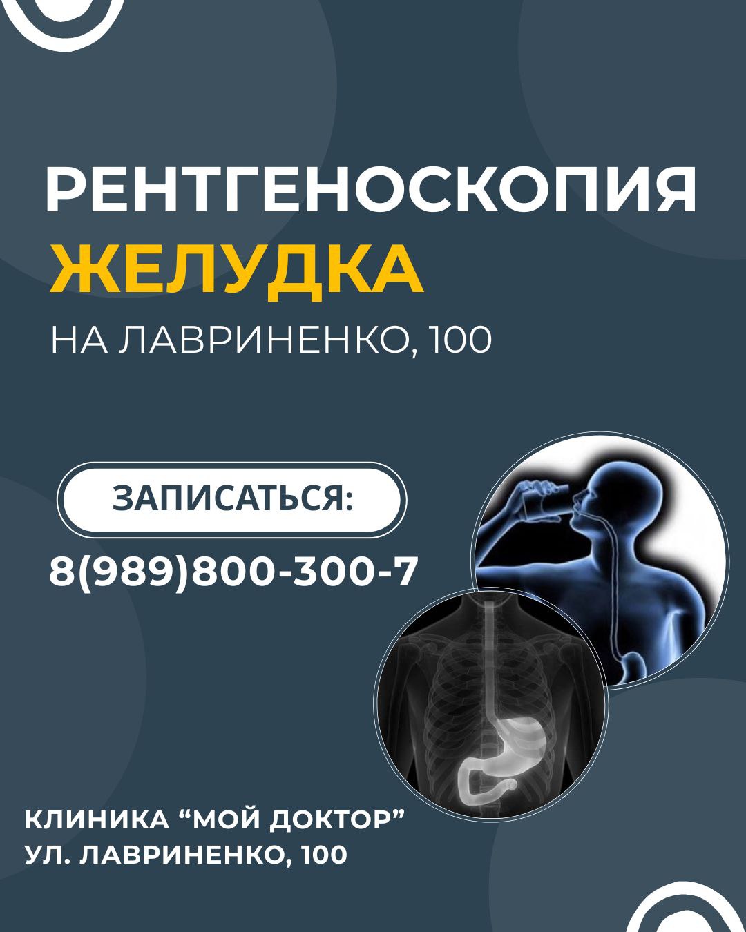 РЕНТГЕНОСКОПИЯ ЖЕЛУДКА В АРМАВИРЕ